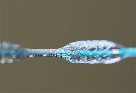  Nitinol :  Un alliage fascinant au cœur des dispositifs médicaux !